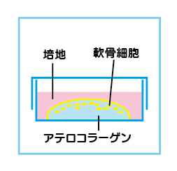 自家培養軟骨の作成